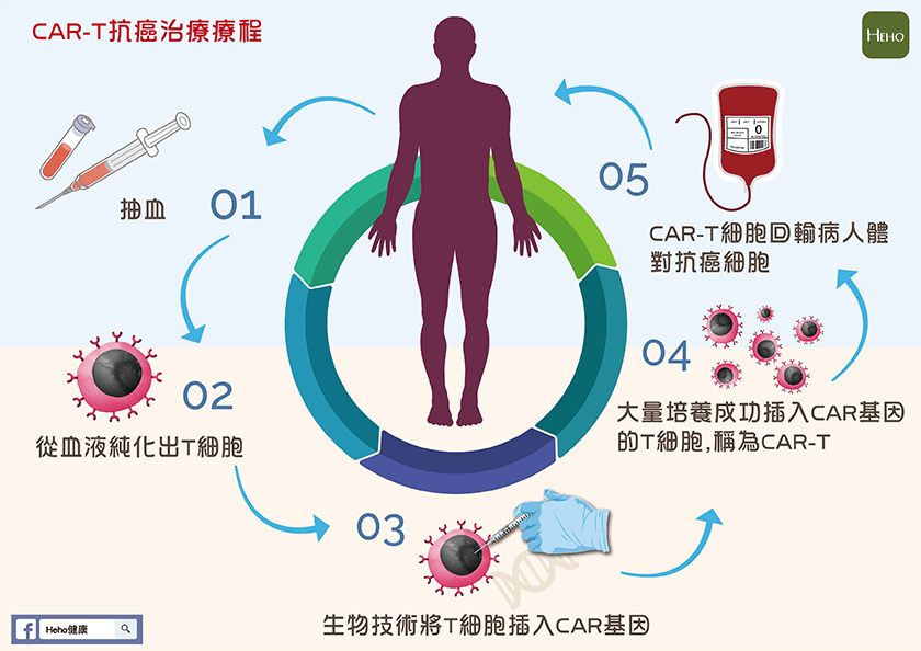实体瘤的新型 CAR T 疗法：“令人兴奋的进展”