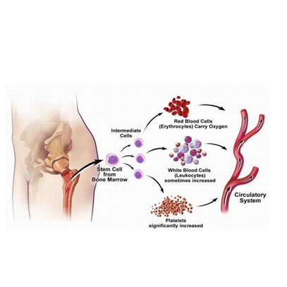 原发性血小板增多症（ET）