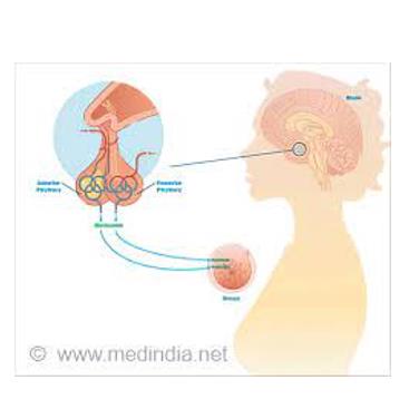 高催乳素血症（HPRL）