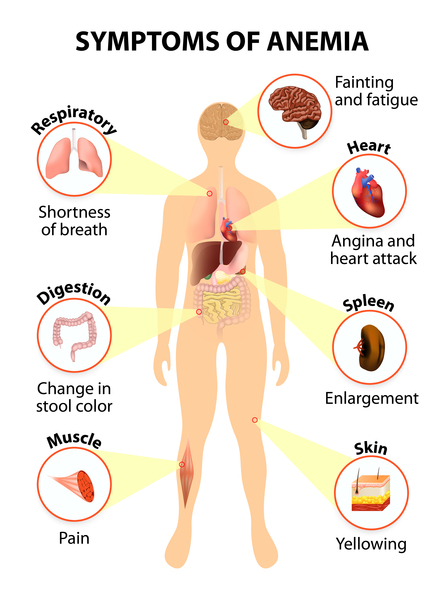 慢性粒细胞白血病 (CML)