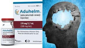 阿杜卡努单抗（Aducanumab）治疗阿尔茨海默症的疗效
