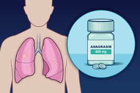 阿达格拉西布（Adagrasib）的中文说明书