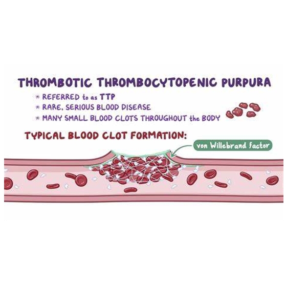 血栓性血小板减少性紫癜（TTP）
