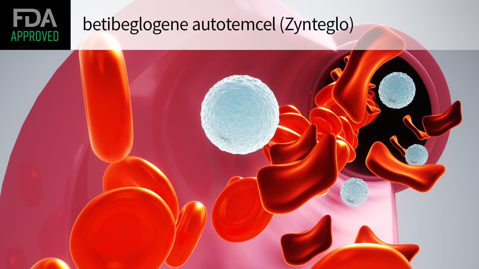 贝蒂格洛根（betibeglogene autotemcel）：革新β-地中海贫血治疗的基因疗法