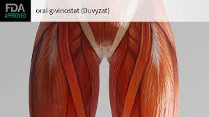 Duvyzat（givinostat）的临床使用指南