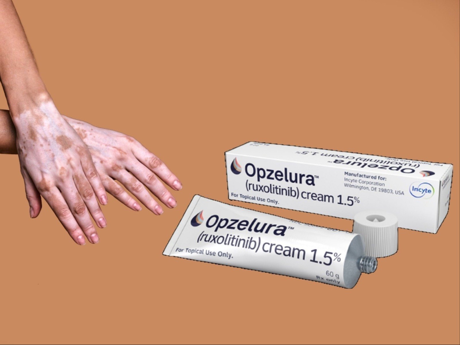 使用芦可替尼乳膏治疗效果如何