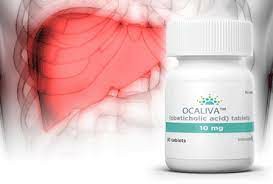 奥贝胆酸（Ocaliva）药物说明书简述