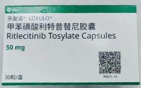 乐复诺治疗斑秃停用会复发吗