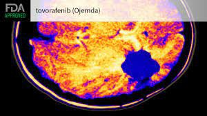 OjeMDA（tovorafenib）的疗效