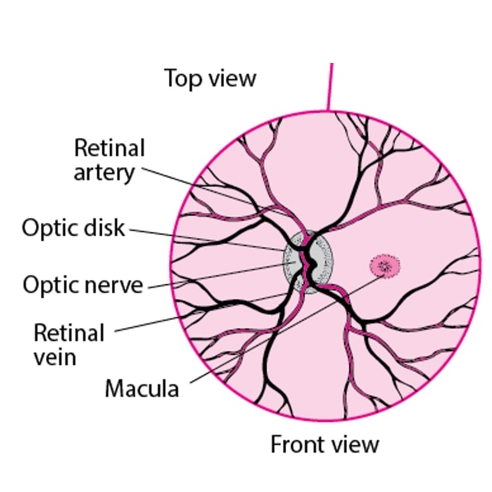早产儿视网膜病 (ROP)