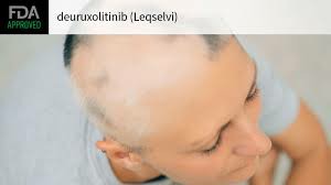 Leqselvi（Deuruxolitinib）的用药方法