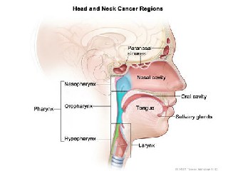 头颈癌是什么疾病？