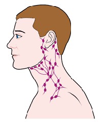头颈癌应该如何治疗？效果如何？