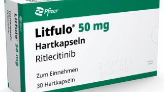 患者对利特昔替尼治疗斑秃的满意度高