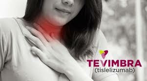 Tevimbra（Tislelizumab-jsgr）的用药方法