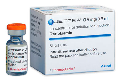 奥克纤溶酶（Ocriplasmin）与黄斑病相关的治疗效果如何