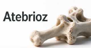 Atebrioz（zilurgisertib）的副作用及注意事项